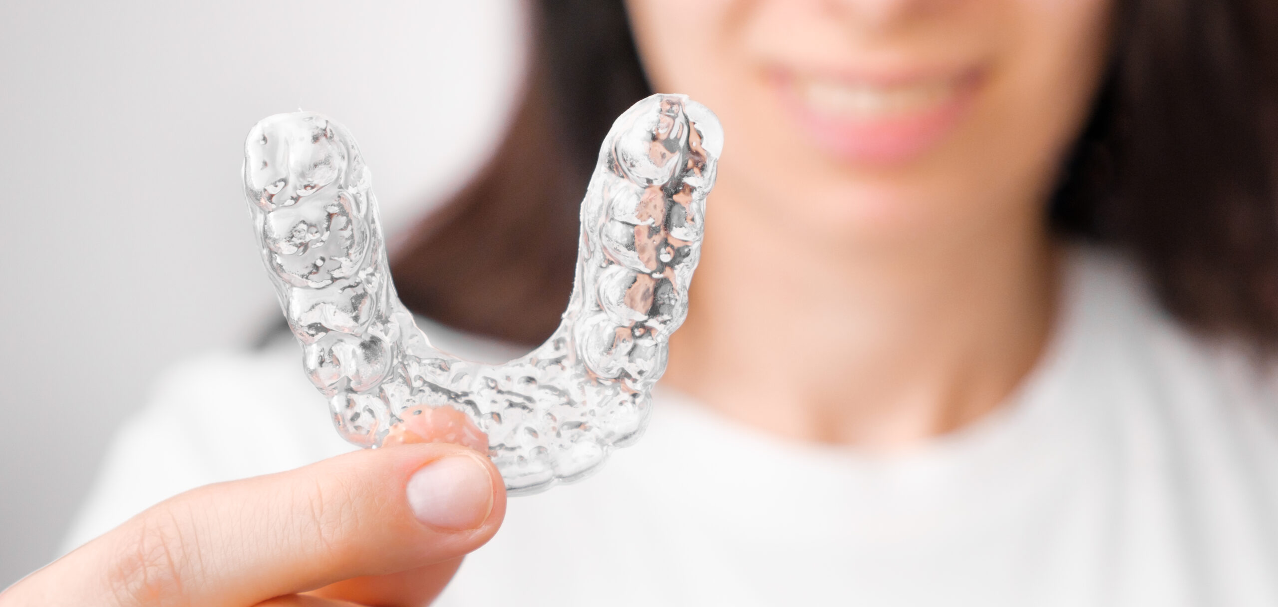 Invisalign, gli apparecchi invisibili per un sorriso perfetto – Servizi di Ortodonzia  e Dentista Roma