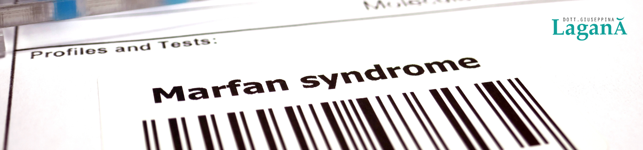 img-marfan sindrome-marfan